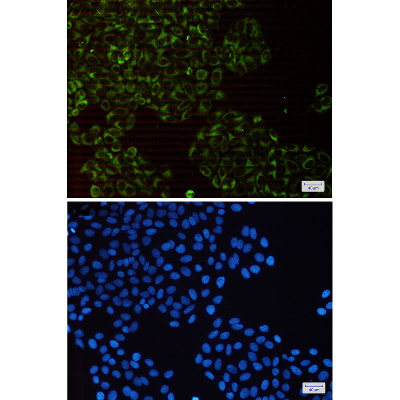 Complex III Subunit 5 Rabbit mAb